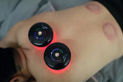Achedaway Cupper Smart Cupping Therapy Massager